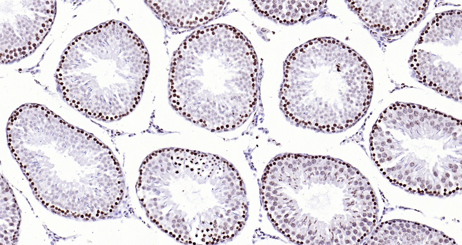 Paraformaldehyde-fixed, paraffin embedded Rat testis; Antigen retrieval by boiling in sodium citrate buffer (pH6.0) for 15min; Block endogenous peroxidase by 3% hydrogen peroxide for 20 minutes; Blocking buffer (normal goat serum) at 37°C for 30min; Antibody incubation with CENPA Polyclonal Antibody, Unconjugated (bs-2753R) at 1:200 overnight at 4°C, DAB staining.