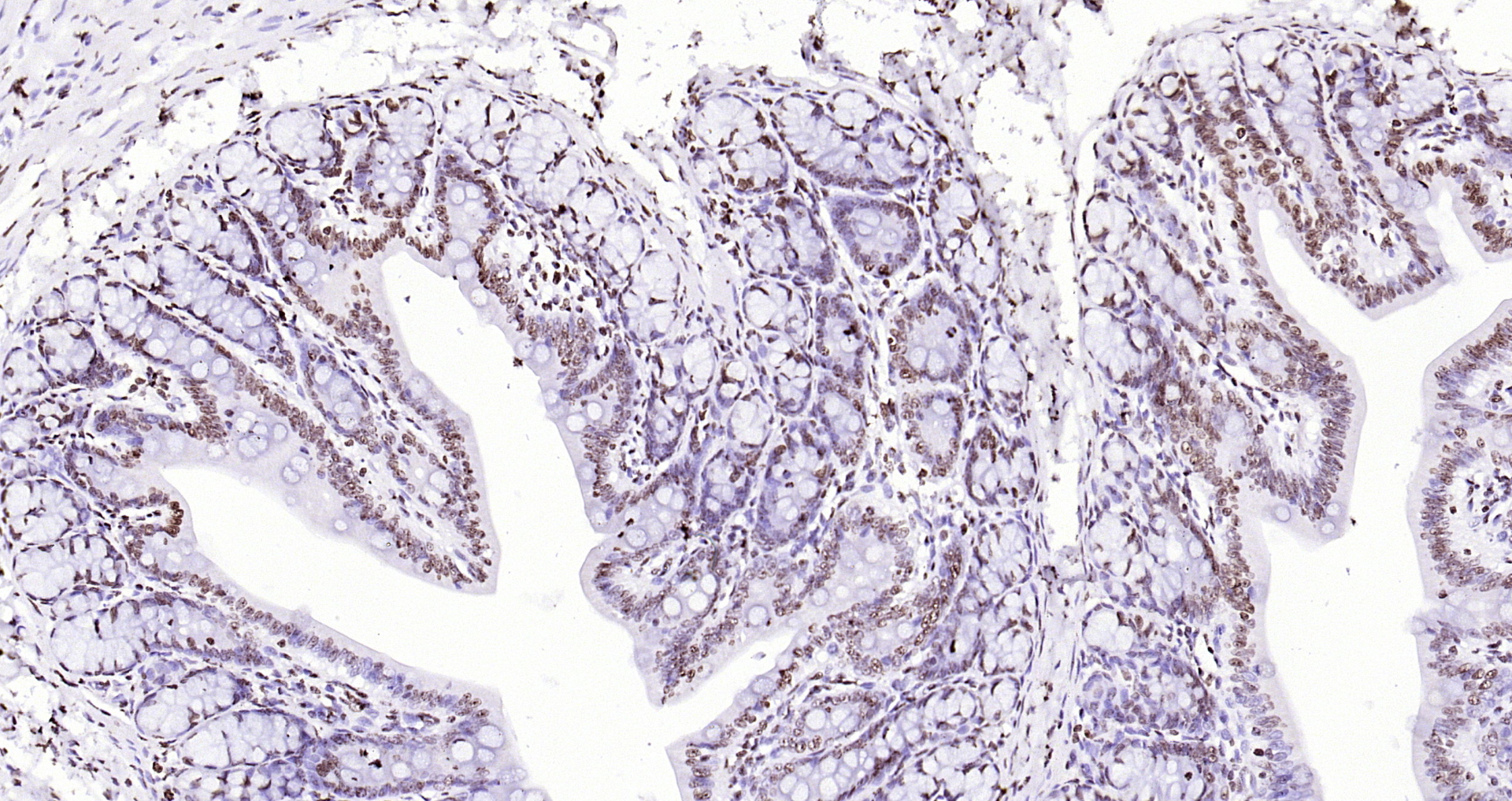 Paraformaldehyde-fixed, paraffin embedded Rat colon; Antigen retrieval by boiling in sodium citrate buffer (pH6.0) for 15min; Block endogenous peroxidase by 3% hydrogen peroxide for 20 minutes; Blocking buffer (normal goat serum) at 37°C for 30min; Antibody incubation with CENPA Polyclonal Antibody, Unconjugated (bs-2753R) at 1:200 overnight at 4°C, DAB staining.