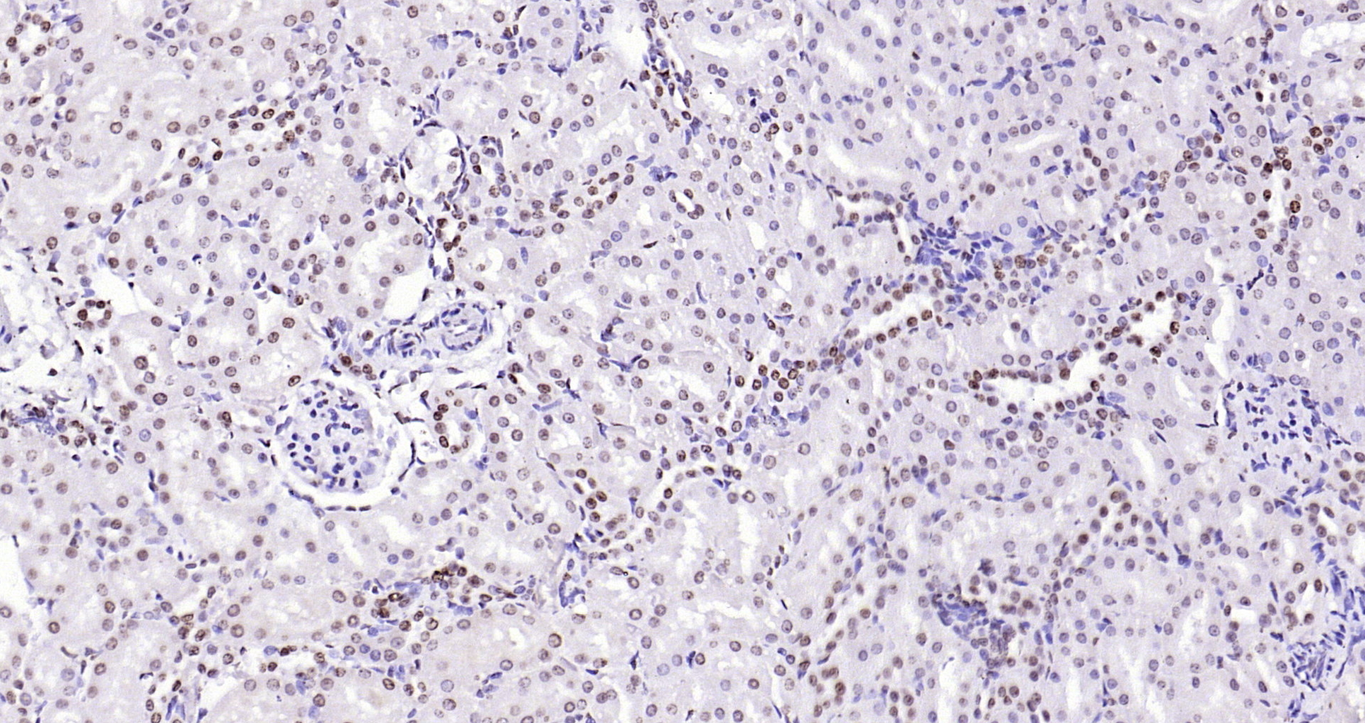 Paraformaldehyde-fixed, paraffin embedded Rat kidney; Antigen retrieval by boiling in sodium citrate buffer (pH6.0) for 15min; Block endogenous peroxidase by 3% hydrogen peroxide for 20 minutes; Blocking buffer (normal goat serum) at 37°C for 30min; Antibody incubation with CENPA Polyclonal Antibody, Unconjugated (bs-2753R) at 1:200 overnight at 4°C, DAB staining.