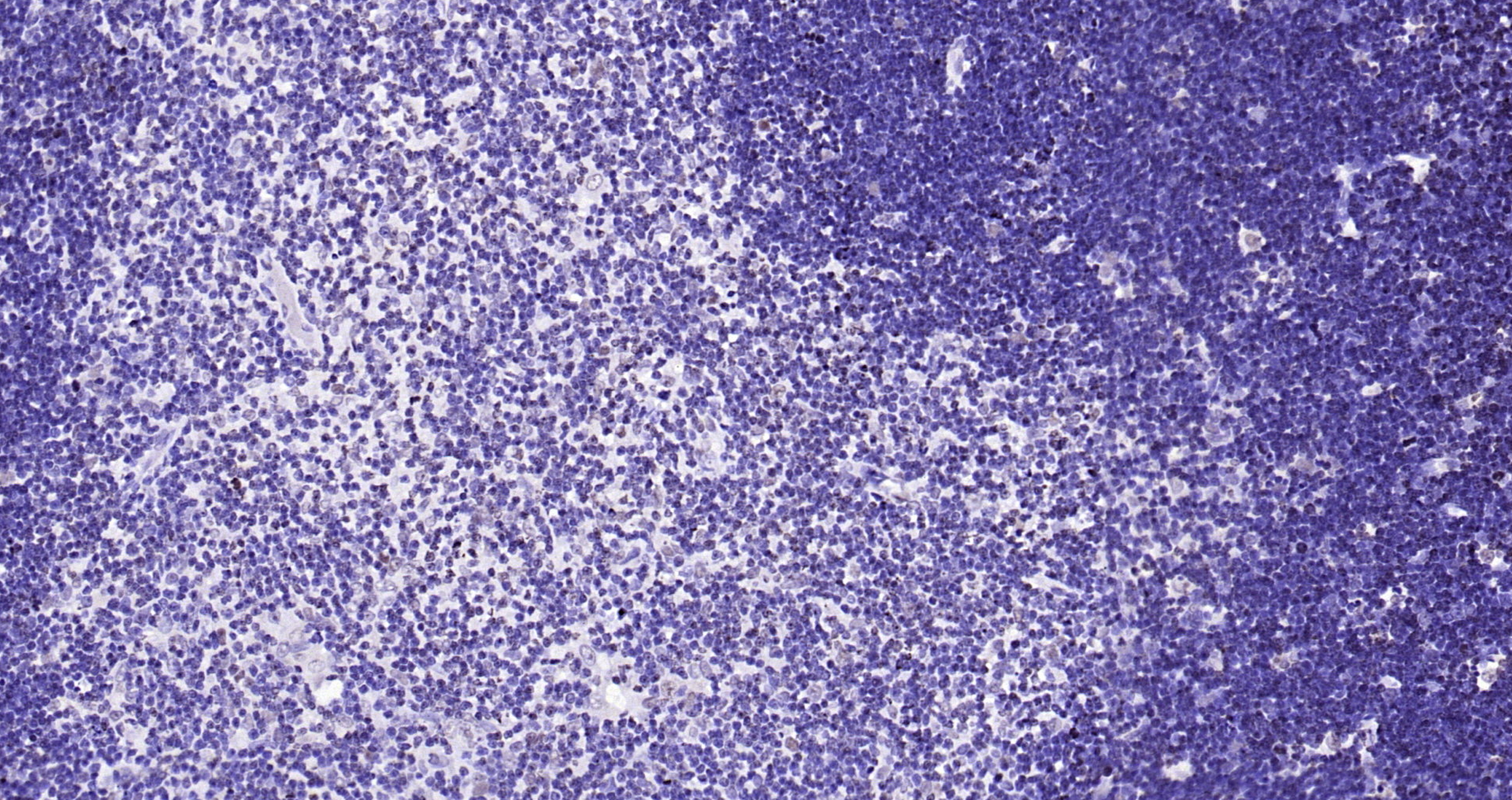 Paraformaldehyde-fixed, paraffin embedded Rat thymus; Antigen retrieval by boiling in sodium citrate buffer (pH6.0) for 15min; Block endogenous peroxidase by 3% hydrogen peroxide for 20 minutes; Blocking buffer (normal goat serum) at 37°C for 30min; Antibody incubation with CENPA Polyclonal Antibody, Unconjugated (bs-2753R) at 1:200 overnight at 4°C, DAB staining.