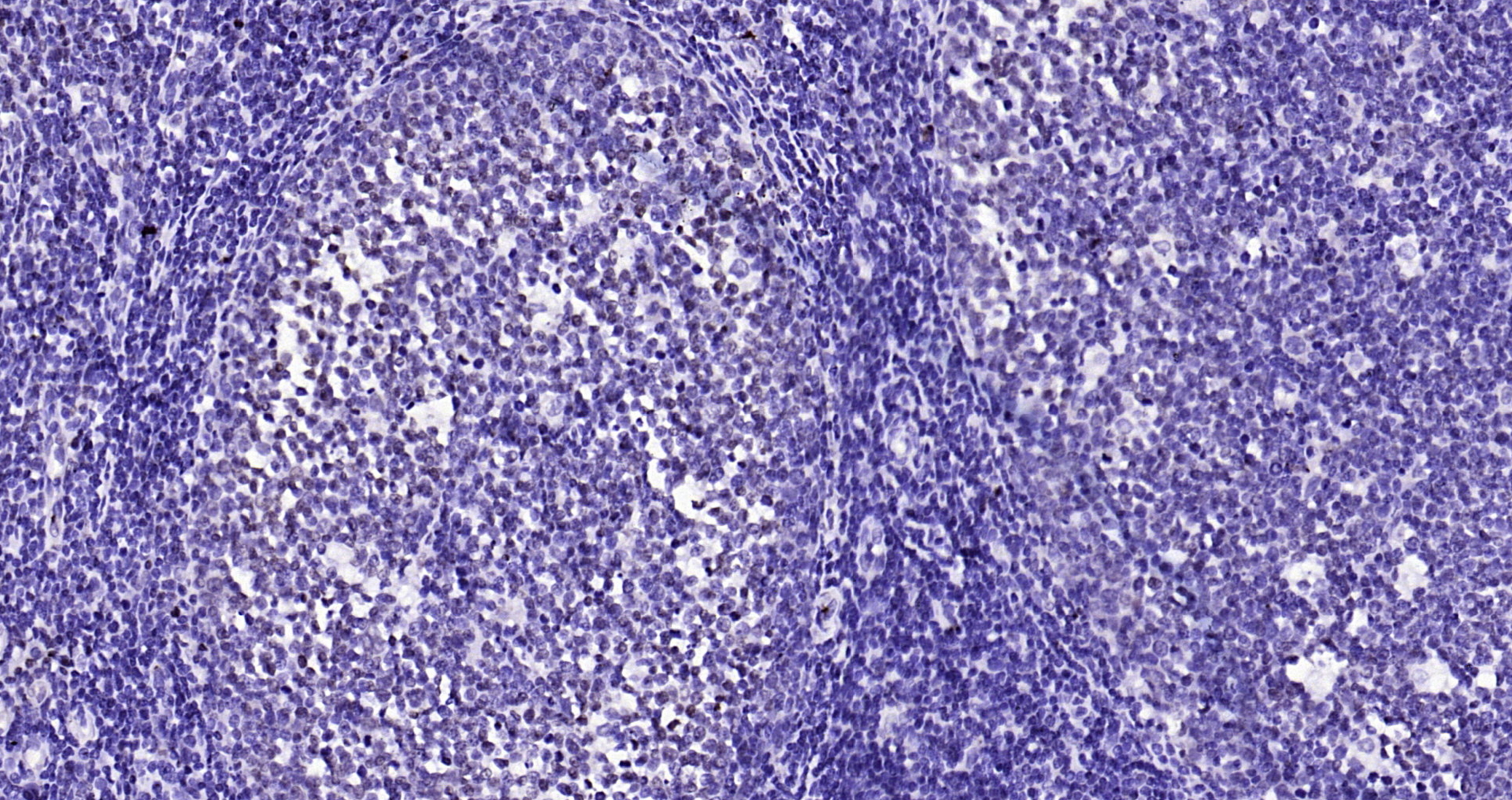 Paraformaldehyde-fixed, paraffin embedded Human tonsil; Antigen retrieval by boiling in sodium citrate buffer (pH6.0) for 15min; Block endogenous peroxidase by 3% hydrogen peroxide for 20 minutes; Blocking buffer (normal goat serum) at 37°C for 30min; Antibody incubation with CENPA Polyclonal Antibody, Unconjugated (bs-2753R) at 1:200 overnight at 4°C, DAB staining.