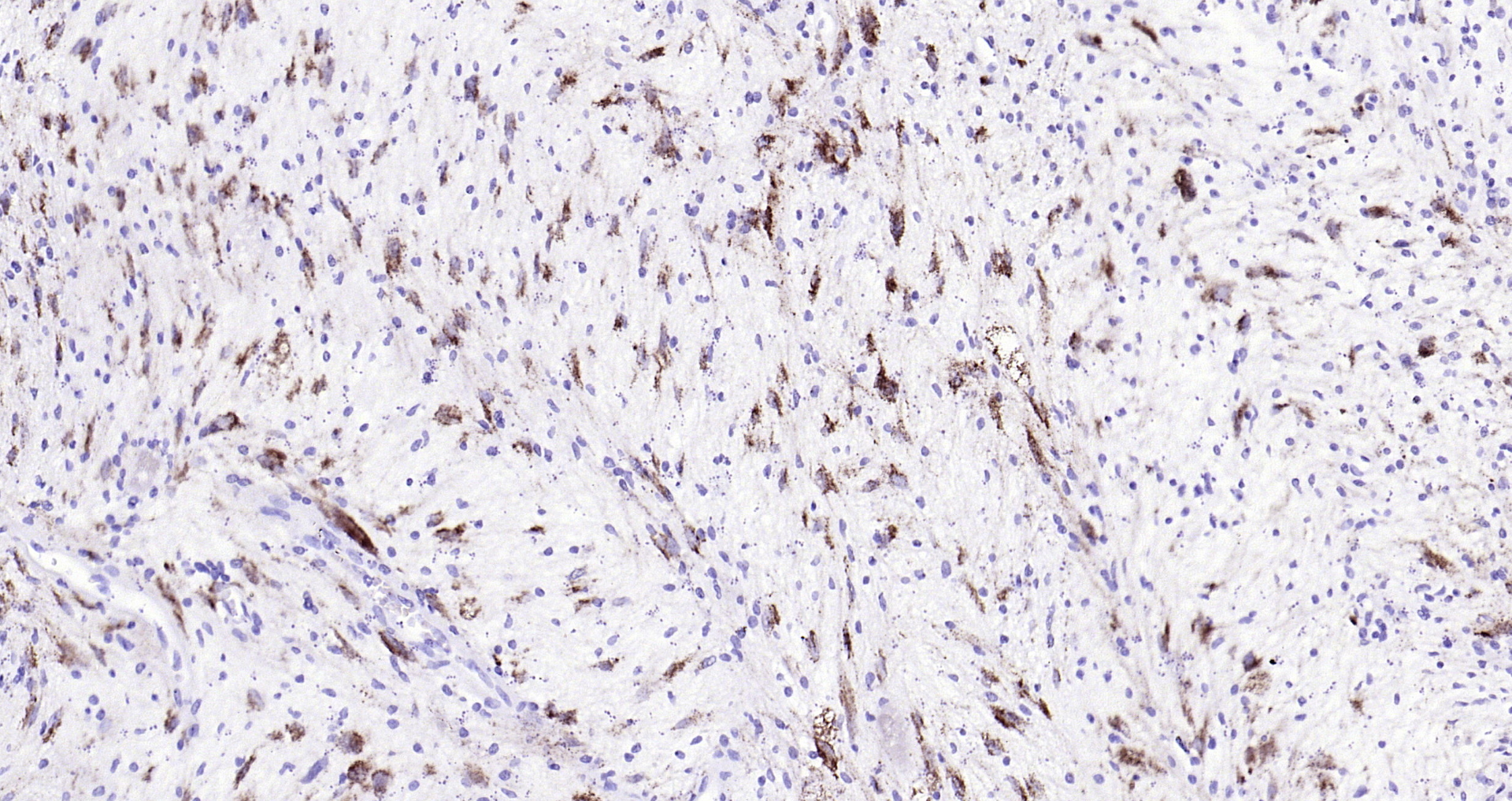 Paraformaldehyde-fixed, paraffin embedded Human neurilemmoma; Antigen retrieval by boiling in sodium citrate buffer (pH6.0) for 15min; Block endogenous peroxidase by 3% hydrogen peroxide for 20 minutes; Blocking buffer (normal goat serum) at 37°C for 30min; Antibody incubation with phospho-Alpha synuclein(Ser129) Monoclonal Antibody, Unconjugated (bsm-41203M) at 1:200 overnight at 4°C, DAB staining.