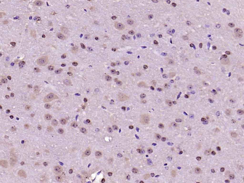 Paraformaldehyde-fixed, paraffin embedded Mouse brain; Antigen retrieval by boiling in sodium citrate buffer (pH6.0) for 15min; Block endogenous peroxidase by 3% hydrogen peroxide for 20 minutes; Blocking buffer (normal goat serum) at 37°C for 30min; Antibody incubation with PAK5 Polyclonal Antibody, Unconjugated (bs-0655R) at 1:200 overnight at 4°C, DAB staining.