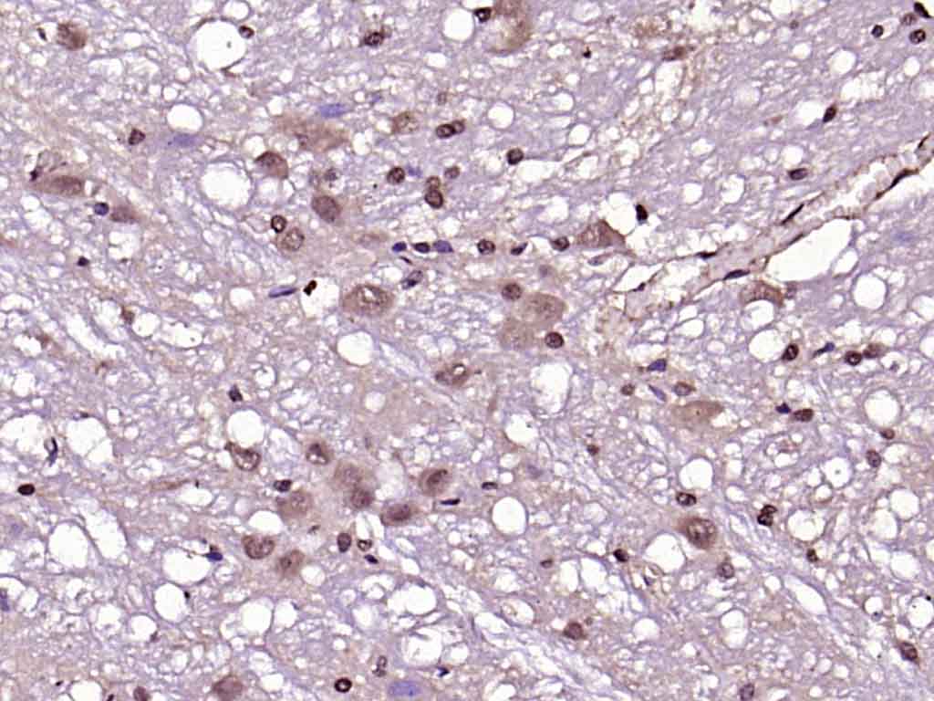 Paraformaldehyde-fixed, paraffin embedded Rat cerebellum; Antigen retrieval by boiling in sodium citrate buffer (pH6.0) for 15min; Block endogenous peroxidase by 3% hydrogen peroxide for 20 minutes; Blocking buffer (normal goat serum) at 37°C for 30min; Antibody incubation with PAK5 Polyclonal Antibody, Unconjugated (bs-0655R) at 1:200 overnight at 4°C, DAB staining.