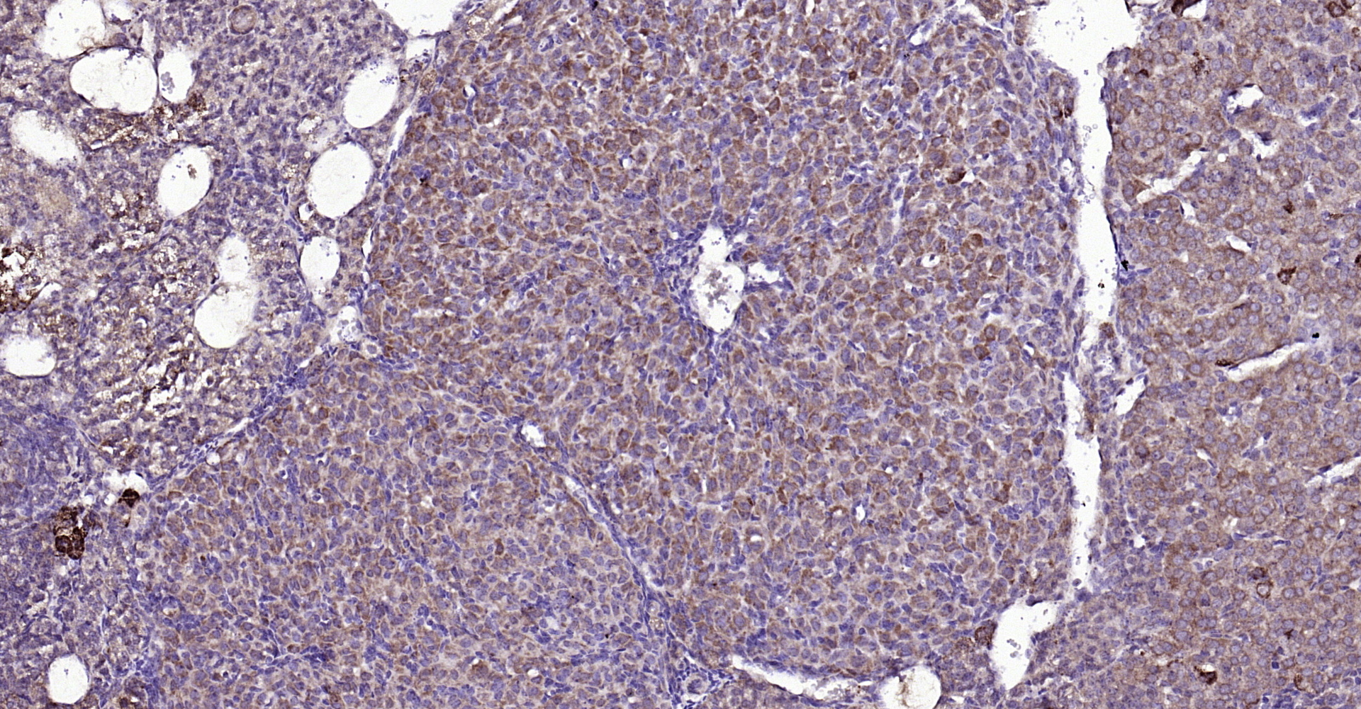 Paraformaldehyde-fixed, paraffin embedded Mouse ovarian; Antigen retrieval by boiling in sodium citrate buffer (pH6.0) for 15min; Block endogenous peroxidase by 3% hydrogen peroxide for 20 minutes; Blocking buffer (normal goat serum) at 37°C for 30min; Antibody incubation with FGF8 Polyclonal Antibody, Unconjugated (bs-0735R) at 1:200 overnight at 4°C, DAB staining.