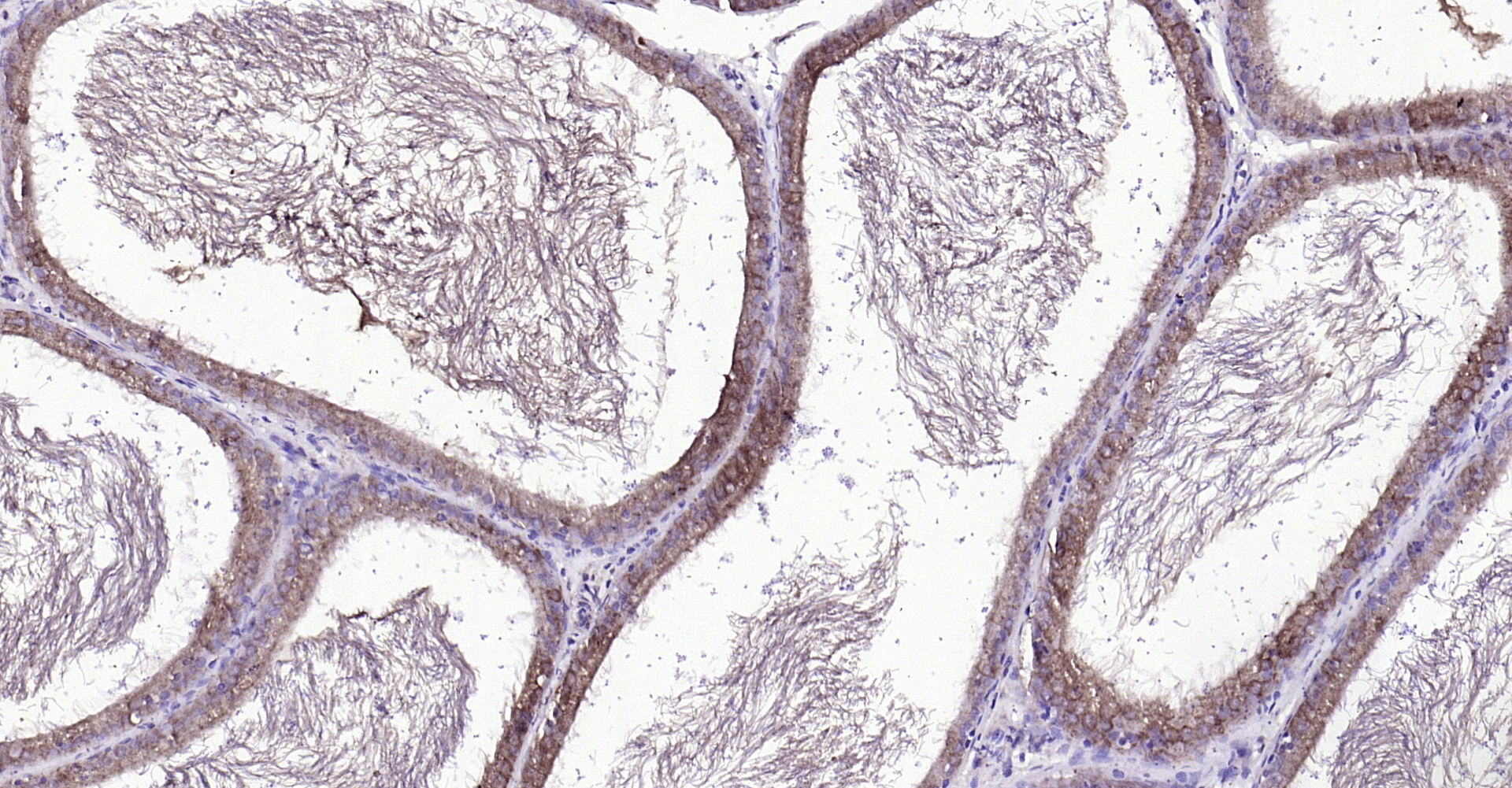 Paraformaldehyde-fixed, paraffin embedded Rat prostate; Antigen retrieval by boiling in sodium citrate buffer (pH6.0) for 15min; Block endogenous peroxidase by 3% hydrogen peroxide for 20 minutes; Blocking buffer (normal goat serum) at 37°C for 30min; Antibody incubation with FGF8 Polyclonal Antibody, Unconjugated (bs-0735R) at 1:200 overnight at 4°C, DAB staining.