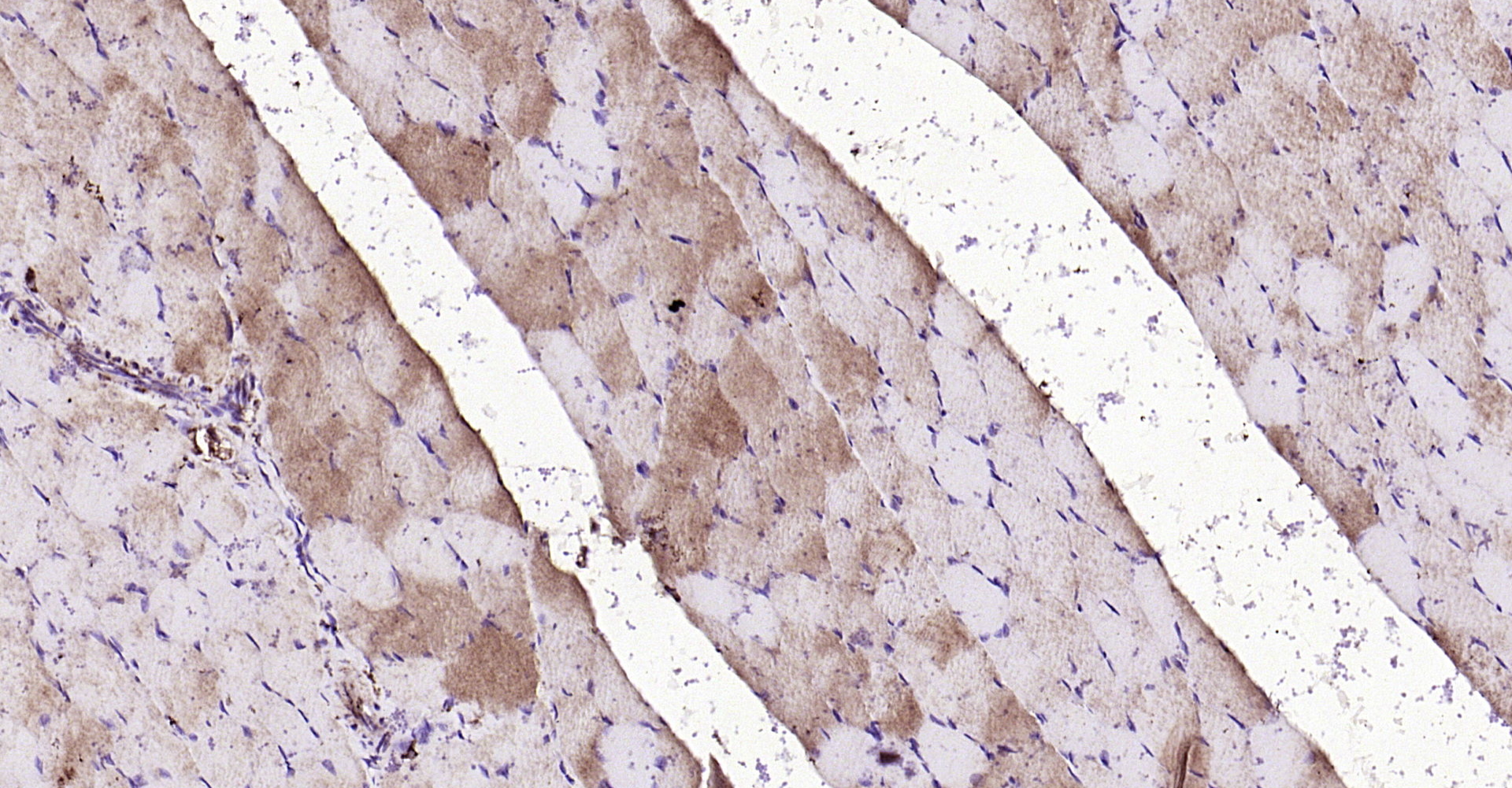 Paraformaldehyde-fixed, paraffin embedded Rat muscle; Antigen retrieval by boiling in sodium citrate buffer (pH6.0) for 15min; Block endogenous peroxidase by 3% hydrogen peroxide for 20 minutes; Blocking buffer (normal goat serum) at 37°C for 30min; Antibody incubation with FGF8 Polyclonal Antibody, Unconjugated (bs-0735R) at 1:200 overnight at 4°C, DAB staining.