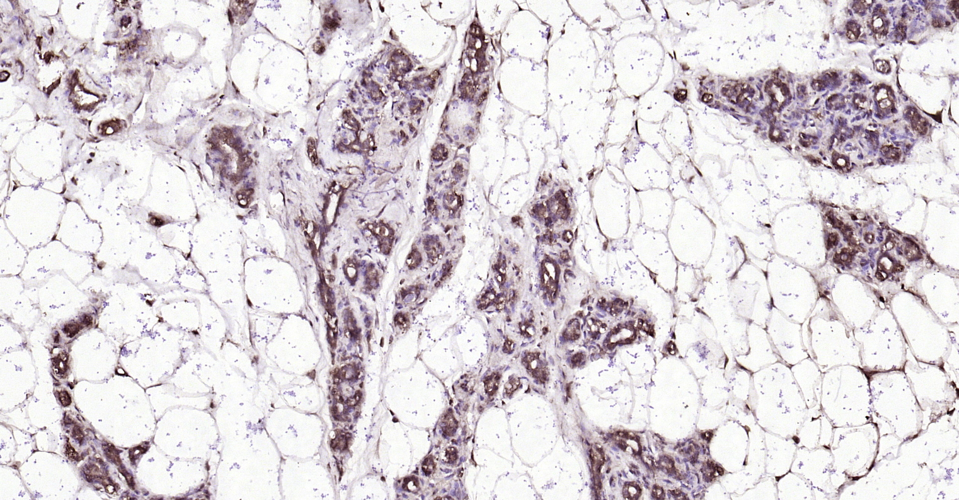 Paraformaldehyde-fixed, paraffin embedded Rat breast; Antigen retrieval by boiling in sodium citrate buffer (pH6.0) for 15min; Block endogenous peroxidase by 3% hydrogen peroxide for 20 minutes; Blocking buffer (normal goat serum) at 37°C for 30min; Antibody incubation with Resistin Polyclonal Antibody, Unconjugated (bs-0795R) at 1:200 overnight at 4°C, DAB staining.