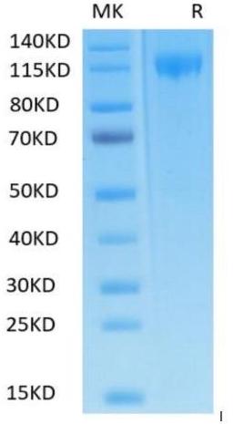 Biotinylated Recombinant SARS-CoV-2 Spike S1 protein on Tris-Bis PAGE under reduced condition. The purity is greater than 95%.