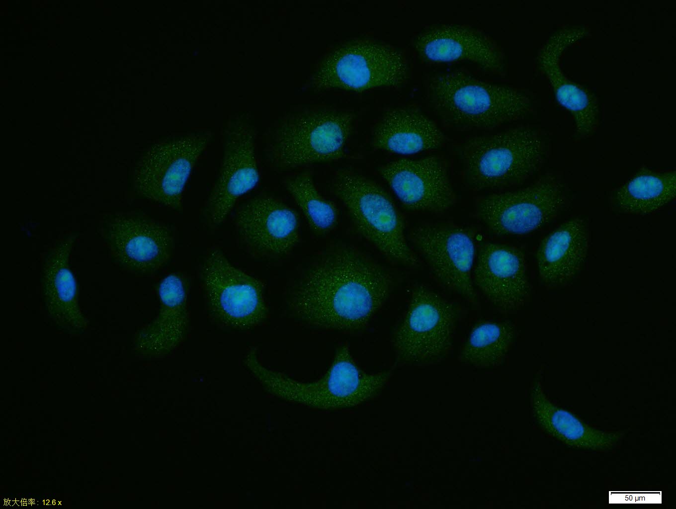 HepG2 cell; 4% Paraformaldehyde-fixed; Triton X-100 at room temperature for 20 min; Blocking buffer (normal goat serum, C-0005) at 37°C for 20 min; Antibody incubation with (eIF4A3) polyclonal Antibody, Unconjugated (bs-14548R) 1:100, 90 minutes at 37°C; followed by a conjugated Goat Anti-Rabbit IgG antibody at 37°C for 90 minutes, DAPI (blue, C02-04002) was used to stain the cell nuclei.