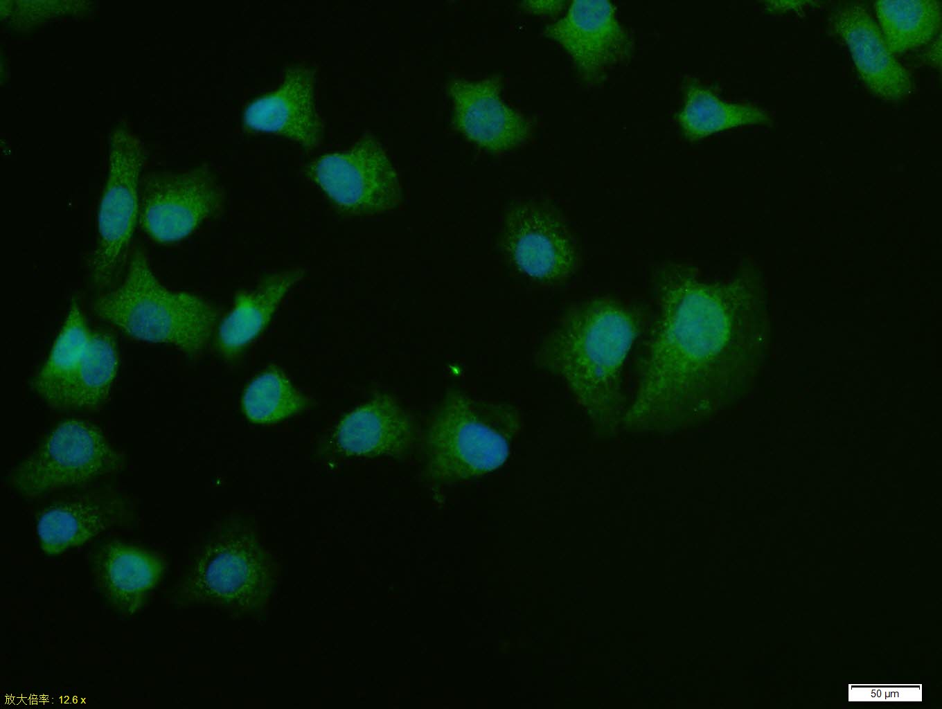 HepG2 cell; 4% Paraformaldehyde-fixed; Triton X-100 at room temperature for 20 min; Blocking buffer (normal goat serum, C-0005) at 37°C for 20 min; Antibody incubation with (PNMT) polyclonal Antibody, Unconjugated (bs-3912R) 1:100, 90 minutes at 37°C; followed by a conjugated Goat Anti-Rabbit IgG antibody at 37°C for 90 minutes, DAPI (blue, C02-04002) was used to stain the cell nuclei.