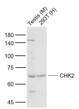 Lane 1: Mouse Testis tissue lysates; Lane 2: Human 293T cell lysates probed with CHK2 Polyclonal Antibody, Unconjugated (bs-11792R) at 1:1000 dilution and 4°C overnight incubation. Followed by conjugated secondary antibody incubation at 1:20000 for 60 min at 37˚C.