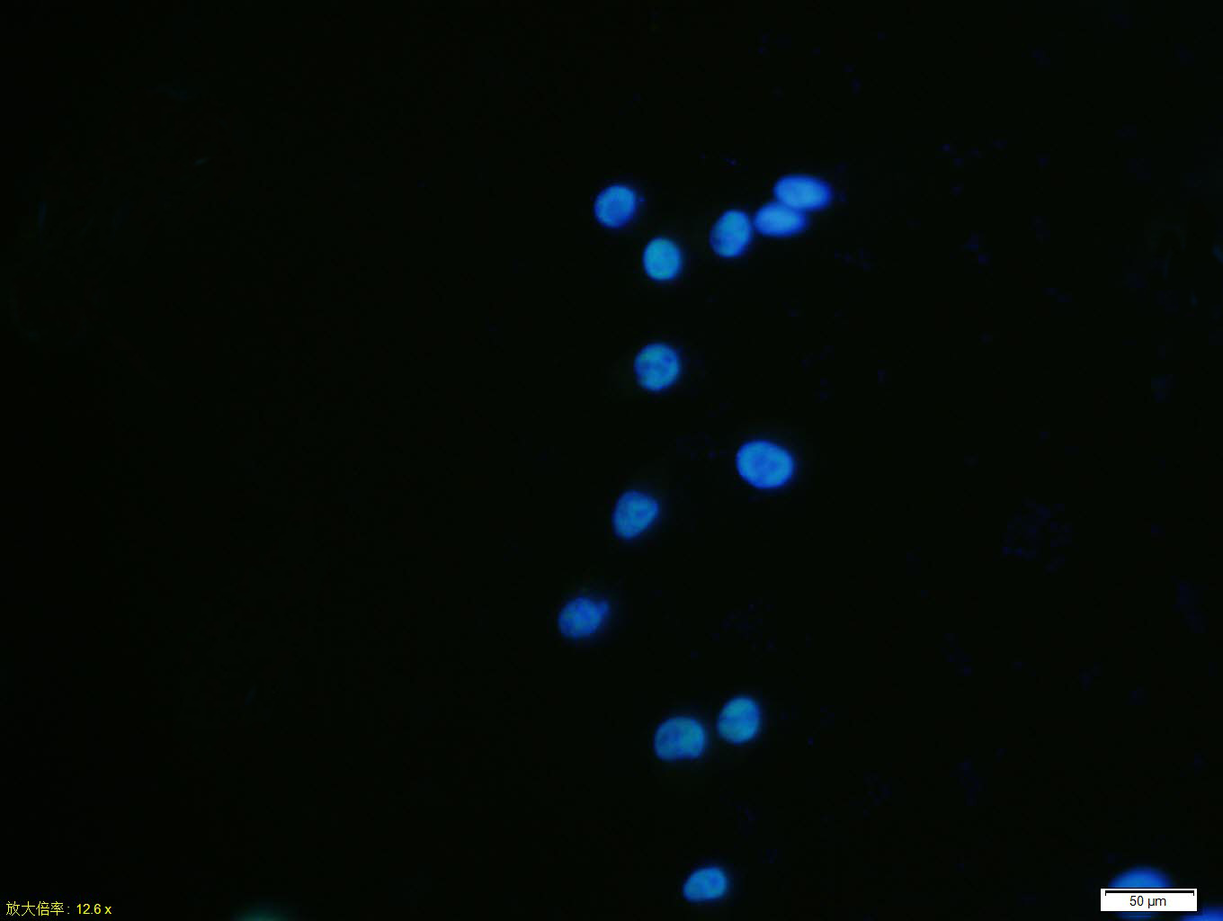 SH-SY5Y cell; 4% Paraformaldehyde-fixed; Triton X-100 at room temperature for 20 min; Blocking buffer (normal goat serum, C-0005) at 37\u00b0C for 20 min; Antibody incubation with (HDAC2) monoclonal Antibody, Unconjugated (bsm-52082R) 1:100, 90 minutes at 37\u00b0C; followed by a conjugated Goat Anti-Rabbit IgG antibody at 37\u00b0C for 90 minutes, DAPI (blue, C02-04002) was used to stain the cell nuclei.