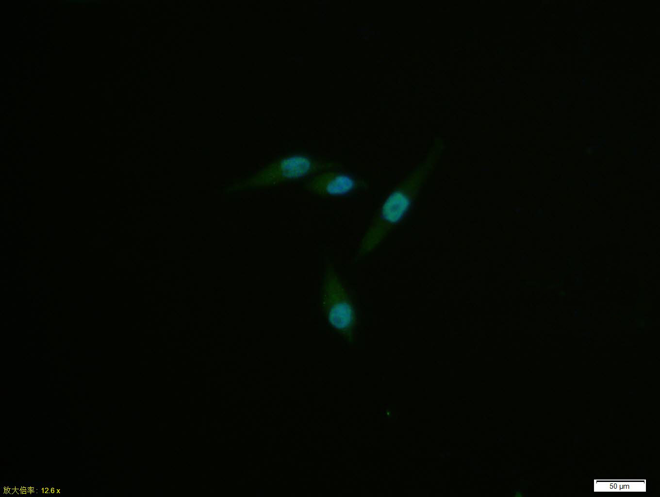 SH-SY5Y cell; 4% Paraformaldehyde-fixed; Triton X-100 at room temperature for 20 min; Blocking buffer (normal goat serum, C-0005) at 37°C for 20 min; Antibody incubation with (Phospho-MSK1 (Ser376)) monoclonal Antibody, Unconjugated (bsm-52123R) 1:100, 90 minutes at 37°C; followed by a conjugated Goat Anti-Rabbit IgG antibody at 37°C for 90 minutes, DAPI (blue, C02-04002) was used to stain the cell nuclei.