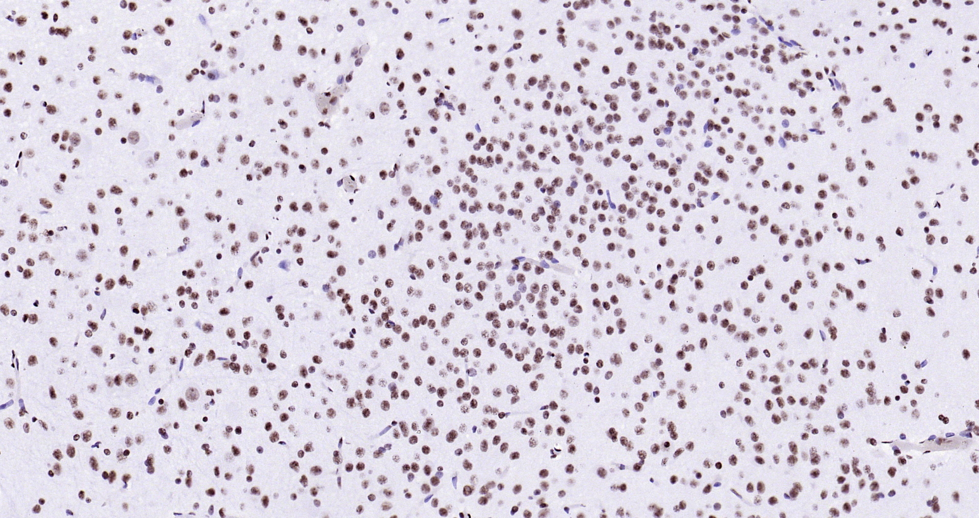 Paraformaldehyde-fixed, paraffin embedded Rat brain; Antigen retrieval by boiling in sodium citrate buffer (pH6.0) for 15min; Block endogenous peroxidase by 3% hydrogen peroxide for 20 minutes; Blocking buffer (normal goat serum) at 37°C for 30min; Antibody incubation with Histone H3 (Tri Methyl K4) Polyclonal Antibody, Unconjugated (bs-4715R) at 1:200 overnight at 4°C, DAB staining.