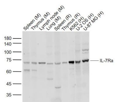 Lane 1: Mouse Spleen tissue lysates; Lane 2: Mouse Thymus tissue lysates; Lane 3: Mouse Lymph node tissue lysates; Lane 4: Mouse Lung tissue lysates; Lane 5: Rat Spleen tissue lysates; Lane 6: Rat Thymus tissue lysates; Lane 7: Human K562 cell lysates; Lane 8: Human U-2 OS cell lysates; Lane 9: Human U-87 MG cell lysates probed with IL-7Ra Polyclonal Antibody, Unconjugated (bs-1540R) at 1:1000 dilution and 4°C overnight incubation. Followed by conjugated secondary antibody incubation at 1:20000 for 60 min at 37˚C._x000D_