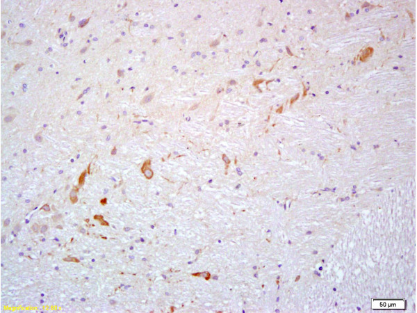 Formalin-fixed and paraffin embedded rat brain labeled with Anti- PROK2/Prokineticin 2 Polyclonal Antibody, Unconjugated (bs-5784R) at 1:200 followed by conjugation to the secondary antibody and DAB staining
