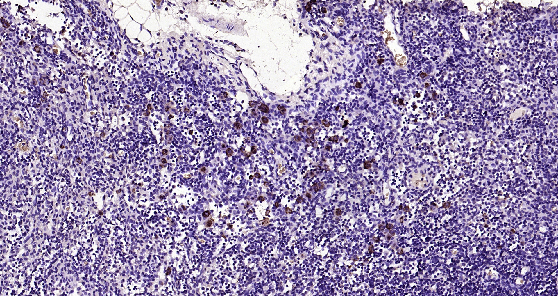 Paraformaldehyde-fixed, paraffin embedded Rat lymph node; Antigen retrieval by boiling in sodium citrate buffer (pH6.0) for 15min; Block endogenous peroxidase by 3% hydrogen peroxide for 20 minutes; Blocking buffer (normal goat serum) at 37°C for 30min; Antibody incubation with CCR7/CD197 Polyclonal Antibody, Unconjugated (bs-1305R) at 1:200 overnight at 4°C, DAB staining.