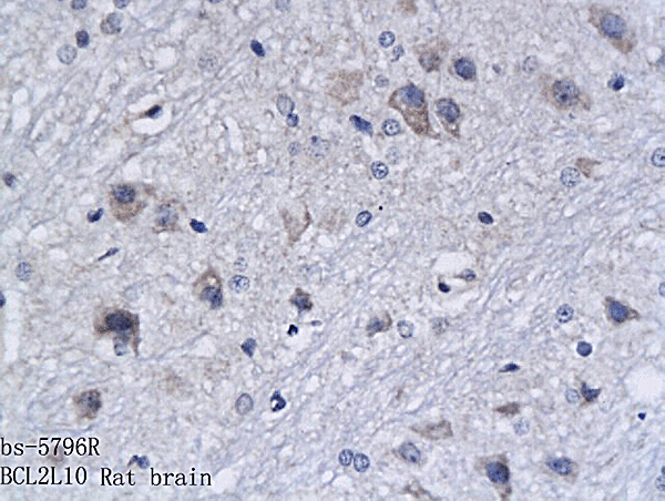Formalin-fixed and paraffin embedded rat brain labeled with Anti-BCL2L10 Polyclonal Antibody, Unconjugated (bs-5796R) followed by conjugation to the secondary antibody and DAB staining