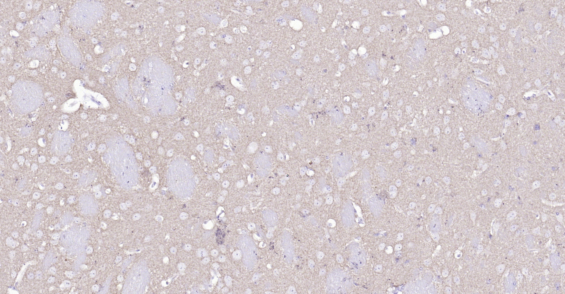 Paraformaldehyde-fixed, paraffin embedded Mouse brain; Antigen retrieval by boiling in sodium citrate buffer (pH6.0) for 15min; Block endogenous peroxidase by 3% hydrogen peroxide for 20 minutes; Blocking buffer (normal goat serum) at 37\u00b0C for 30min; Antibody incubation with Alpha-Synuclein Polyclonal Antibody, Unconjugated (bs-0968R) at 1:200 overnight at 4\u00b0C, DAB staining.