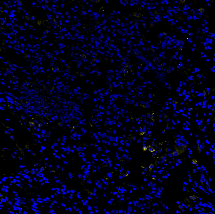 Hamster lung IF staining