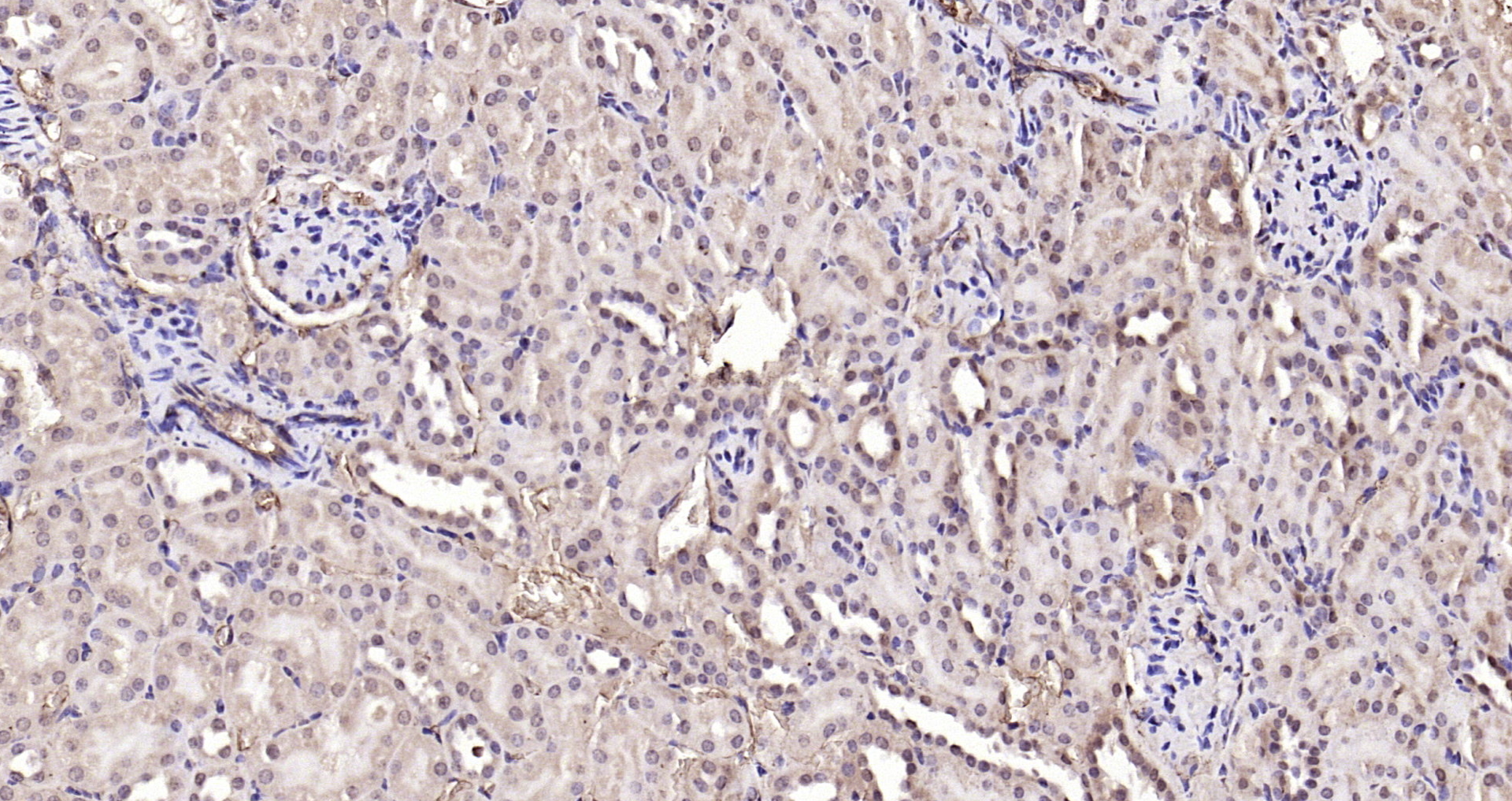 Paraformaldehyde-fixed, paraffin embedded Mouse kidney; Antigen retrieval by boiling in sodium citrate buffer (pH6.0) for 15min; Block endogenous peroxidase by 3% hydrogen peroxide for 20 minutes; Blocking buffer (normal goat serum) at 37°C for 30min; Antibody incubation with NADPH oxidase 4 Polyclonal Antibody, Unconjugated (bs-1091R) at 1:200 overnight at 4°C, DAB staining. Paraformaldehyde-fixed, paraffin embedded Mouse kidney; Antigen retrieval by boiling in sodium citrate buffer (pH6.0) for 15min; Block endogenous peroxidase by 3% hydrogen peroxide for 20 minutes; Blocking buffer (normal goat serum) at 37°C for 30min; Antibody incubation with NADPH oxidase 4 Polyclonal Antibody, Unconjugated (bs-1091R) at 1:200 overnight at 4°C, DAB staining.