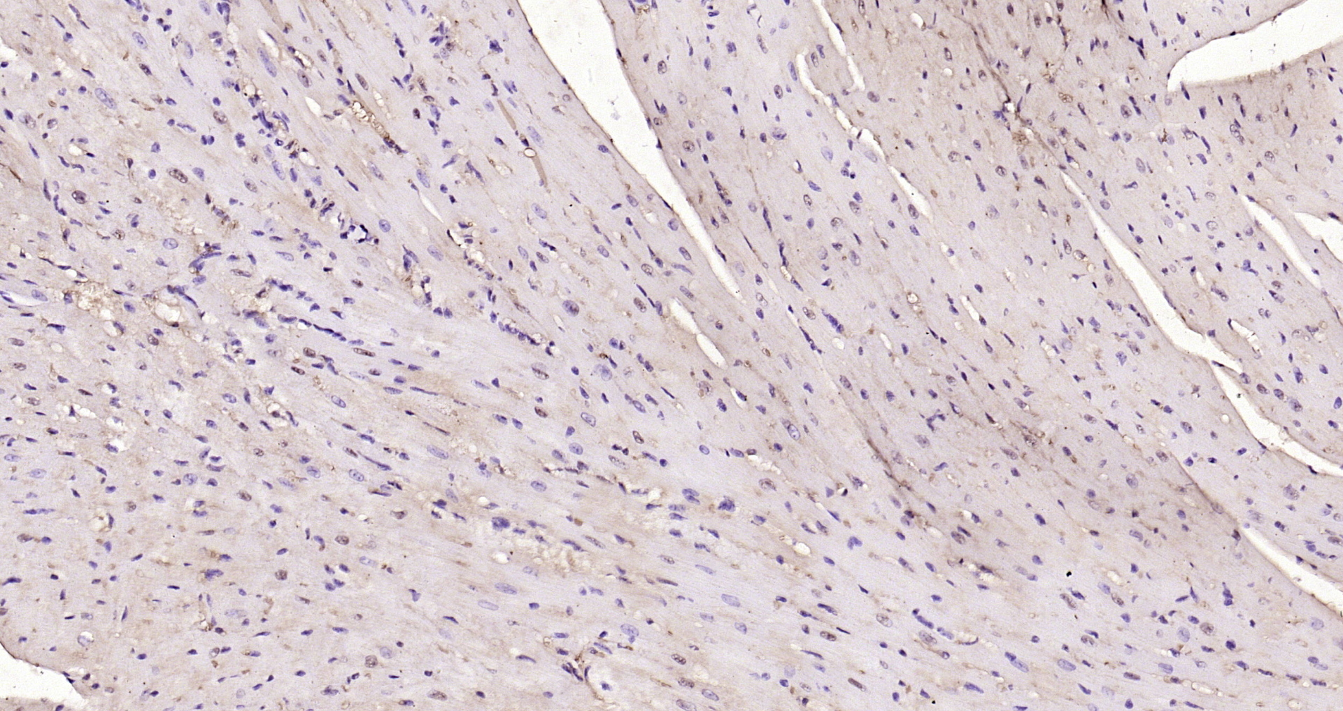 Paraformaldehyde-fixed, paraffin embedded Mouse heart; Antigen retrieval by boiling in sodium citrate buffer (pH6.0) for 15min; Block endogenous peroxidase by 3% hydrogen peroxide for 20 minutes; Blocking buffer (normal goat serum) at 37°C for 30min; Antibody incubation with NADPH oxidase 4 Polyclonal Antibody, Unconjugated (bs-1091R) at 1:200 overnight at 4°C, DAB staining. Paraformaldehyde-fixed, paraffin embedded Mouse heart; Antigen retrieval by boiling in sodium citrate buffer (pH6.0) for 15min; Block endogenous peroxidase by 3% hydrogen peroxide for 20 minutes; Blocking buffer (normal goat serum) at 37°C for 30min; Antibody incubation with NADPH oxidase 4 Polyclonal Antibody, Unconjugated (bs-1091R) at 1:200 overnight at 4°C, DAB staining.