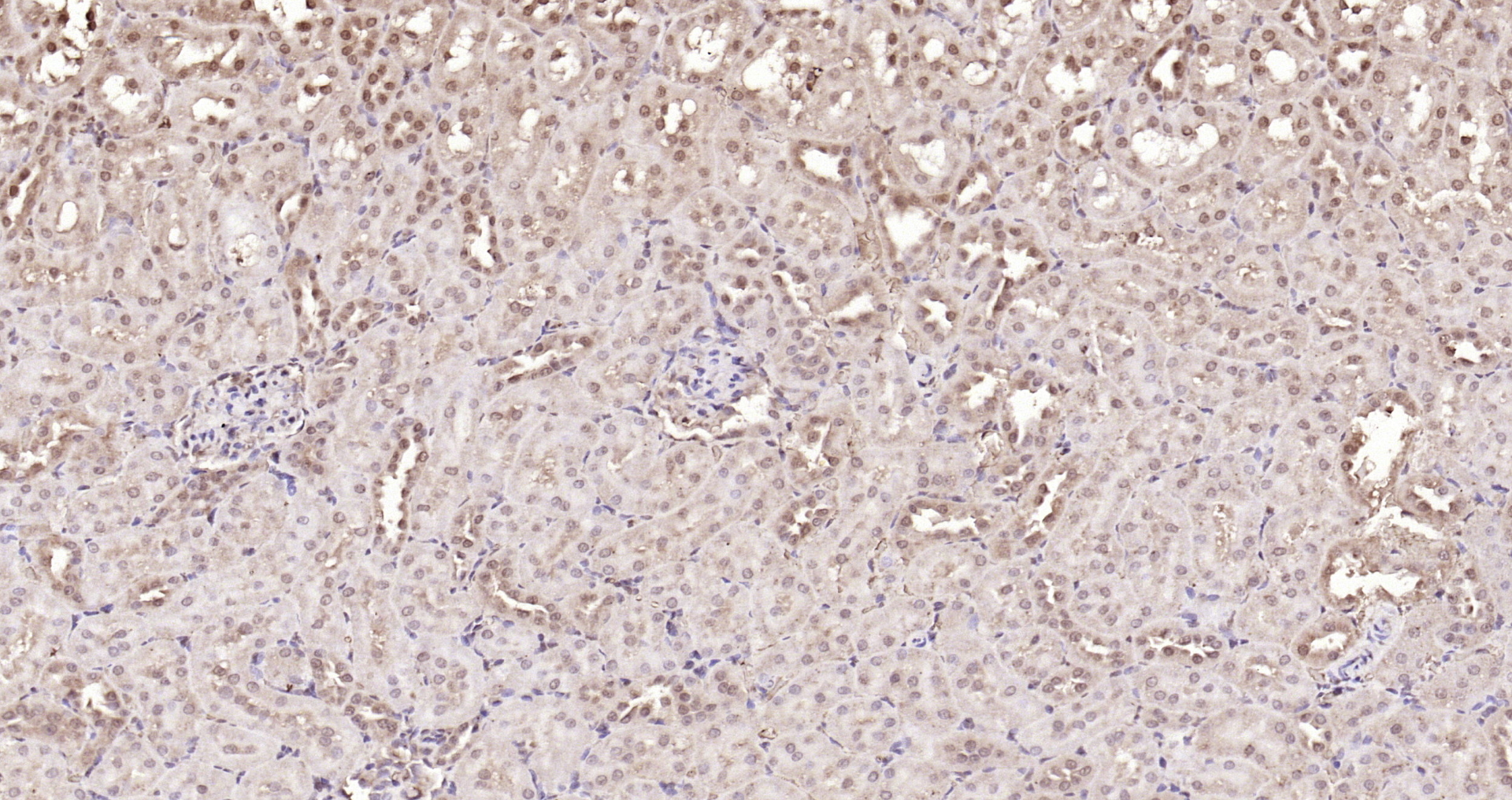 Paraformaldehyde-fixed, paraffin embedded Rat kidney; Antigen retrieval by boiling in sodium citrate buffer (pH6.0) for 15min; Block endogenous peroxidase by 3% hydrogen peroxide for 20 minutes; Blocking buffer (normal goat serum) at 37°C for 30min; Antibody incubation with NADPH oxidase 4 Polyclonal Antibody, Unconjugated (bs-1091R) at 1:200 overnight at 4°C, DAB staining. Paraformaldehyde-fixed, paraffin embedded Rat kidney; Antigen retrieval by boiling in sodium citrate buffer (pH6.0) for 15min; Block endogenous peroxidase by 3% hydrogen peroxide for 20 minutes; Blocking buffer (normal goat serum) at 37°C for 30min; Antibody incubation with NADPH oxidase 4 Polyclonal Antibody, Unconjugated (bs-1091R) at 1:200 overnight at 4°C, DAB staining.