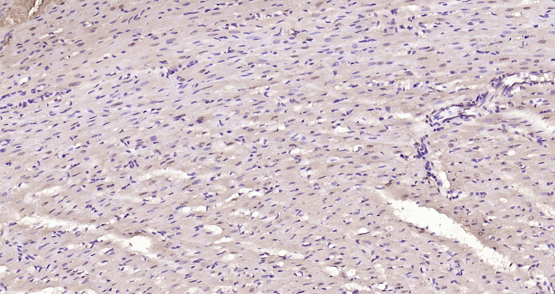 Paraformaldehyde-fixed, paraffin embedded Rat heart; Antigen retrieval by boiling in sodium citrate buffer (pH6.0) for 15min; Block endogenous peroxidase by 3% hydrogen peroxide for 20 minutes; Blocking buffer (normal goat serum) at 37°C for 30min; Antibody incubation with NADPH oxidase 4 Polyclonal Antibody, Unconjugated (bs-1091R) at 1:200 overnight at 4°C, DAB staining. Paraformaldehyde-fixed, paraffin embedded Rat heart; Antigen retrieval by boiling in sodium citrate buffer (pH6.0) for 15min; Block endogenous peroxidase by 3% hydrogen peroxide for 20 minutes; Blocking buffer (normal goat serum) at 37°C for 30min; Antibody incubation with NADPH oxidase 4 Polyclonal Antibody, Unconjugated (bs-1091R) at 1:200 overnight at 4°C, DAB staining.