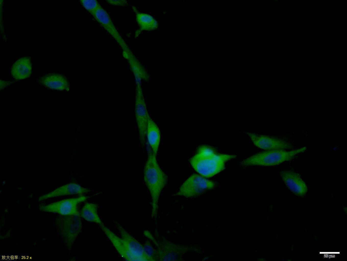 U87MG cell; 4% Paraformaldehyde-fixed; Triton X-100 at room temperature for 20 min; Blocking buffer (normal goat serum, C-0005) at 37°C for 20 min; Antibody incubation with (BBS1) polyclonal Antibody, Unconjugated (bs-11507R) 1:100, 90 minutes at 37°C; followed by a conjugated Goat Anti-Rabbit IgG antibody at 37°C for 90 minutes, DAPI (blue, C02-04002) was used to stain the cell nuclei.