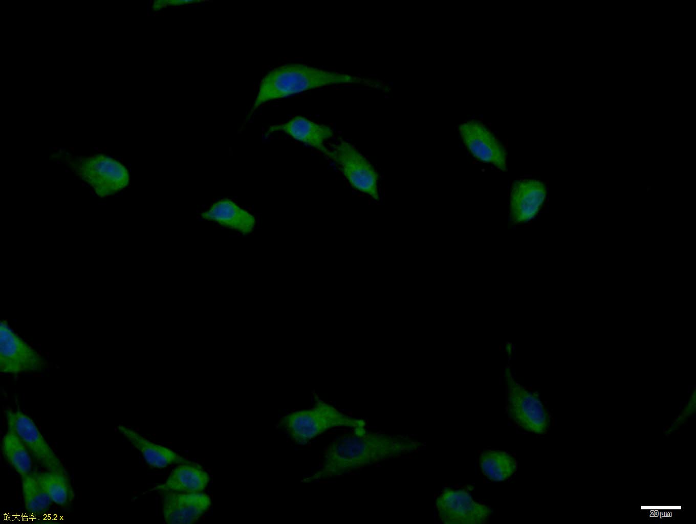 U87MG cell; 4% Paraformaldehyde-fixed; Triton X-100 at room temperature for 20 min; Blocking buffer (normal goat serum, C-0005) at 37°C for 20 min; Antibody incubation with (DDIT3) polyclonal Antibody, Unconjugated (bs-1361R) 1:100, 90 minutes at 37°C; followed by a conjugated Goat Anti-Rabbit IgG antibody at 37°C for 90 minutes, DAPI (blue, C02-04002) was used to stain the cell nuclei.