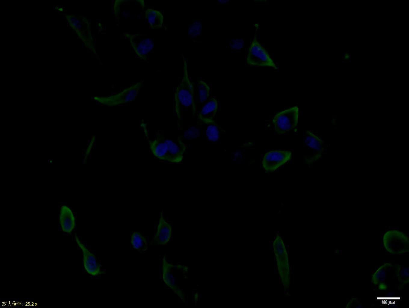 U87MG cell; 4% Paraformaldehyde-fixed; Triton X-100 at room temperature for 20 min; Blocking buffer (normal goat serum, C-0005) at 37°C for 20 min; Antibody incubation with (EGF) polyclonal Antibody, Unconjugated (bs-2008R) 1:100, 90 minutes at 37°C; followed by a conjugated Goat Anti-Rabbit IgG antibody at 37°C for 90 minutes, DAPI (blue, C02-04002) was used to stain the cell nuclei.