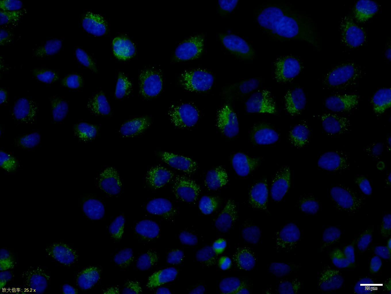 Hela cell; 4% Paraformaldehyde-fixed; Triton X-100 at room temperature for 20 min; Blocking buffer (normal goat serum, C-0005) at 37°C for 20 min; Antibody incubation with (ZDHHC8/ZNF378) polyclonal Antibody, Unconjugated (bs-18486R) 1:100, 90 minutes at 37°C; followed by a conjugated Goat Anti-Rabbit IgG antibody at 37°C for 90 minutes, DAPI (blue, C02-04002) was used to stain the cell nuclei.