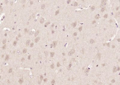 Paraformaldehyde-fixed, paraffin-embedded (rat brain); Antigen retrieval by boiling in sodium citrate buffer (pH6.0) for 15min; Block endogenous peroxidase by 3% hydrogen peroxide for 20 minutes; Blocking buffer (normal goat serum) at 37°C for 30min; Antibody incubation with (NAC1) Polyclonal Antibody, Unconjugated (bs-12247R) at 1:200 overnight at 4°C, followed DAB staining.