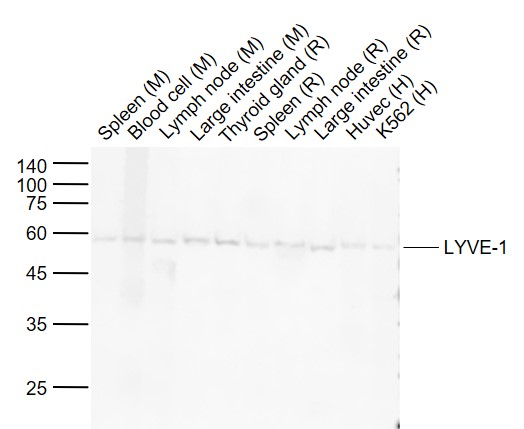 Lane 1: Mouse Spleen tissue lysates; Lane 2: Mouse Blood cell lysates; Lane 3: Mouse Lymph node tissue lysates ; Lane 4: Mouse Large intestine tissue lysates ; Lane 5: Rat Thyroid gland tissue lysates; Lane 6: Rat Spleen tissue lysates; Lane 7: Rat Lymph node tissue lysates; Lane 8: Rat Large intestine tissue lysates; Lane 9: Human Huvec cell lysates; Lane 10: Human K562 cell lysates probed with LYVE-1 Polyclonal Antibody, Unconjugated (bs-20353R) at 1:1000 dilution and 4°C overnight incubation. Followed by conjugated secondary antibody incubation at 1:20000 for 60 min at 37˚C.