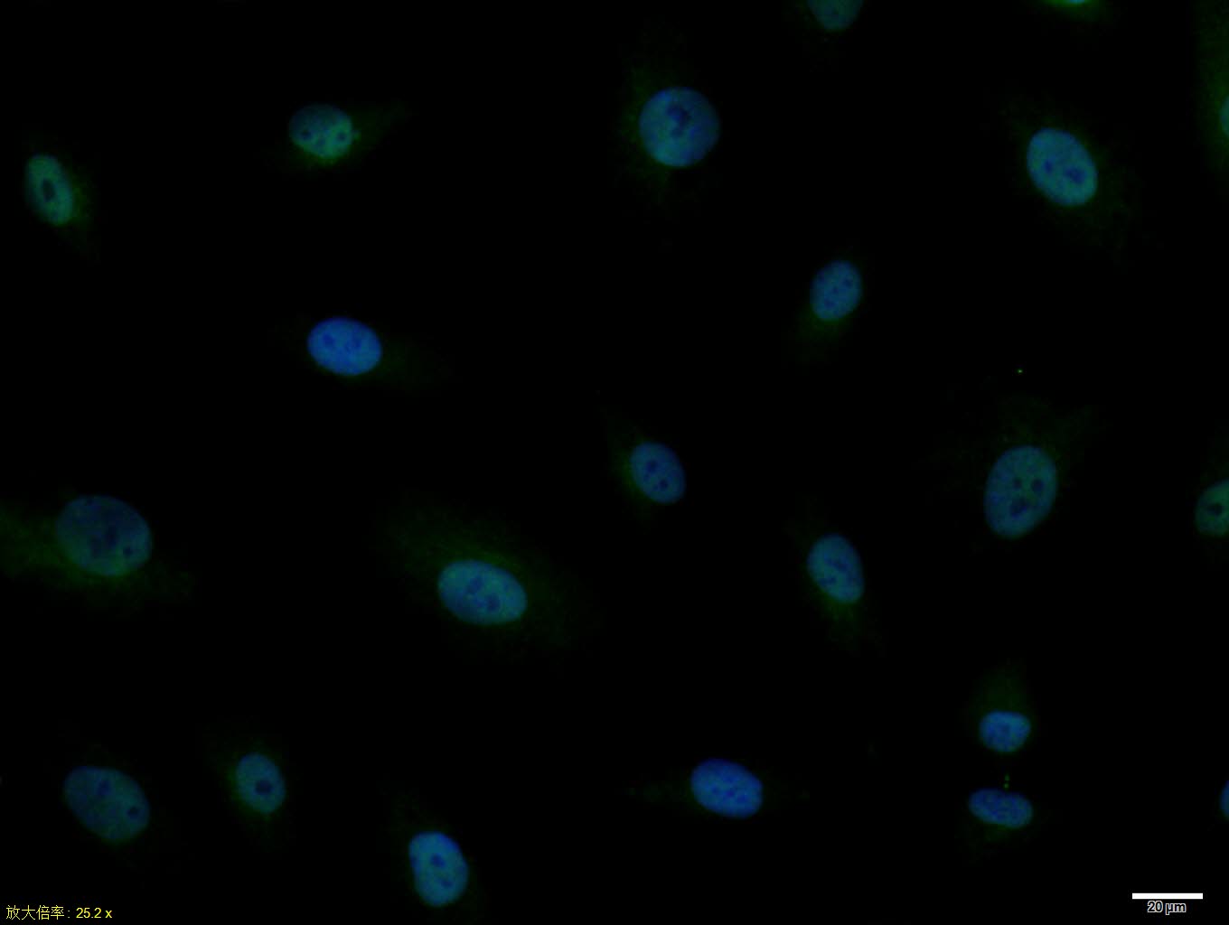 A549 cell; 4% Paraformaldehyde-fixed; Triton X-100 at room temperature for 20 min; Blocking buffer (normal goat serum, C-0005) at 37°C for 20 min; Antibody incubation with (MASH1) polyclonal Antibody, Unconjugated (bs-1155R) 1:100, 90 minutes at 37°C; followed by a conjugated Goat Anti-Rabbit IgG antibody at 37°C for 90 minutes, DAPI (blue, C02-04002) was used to stain the cell nuclei.