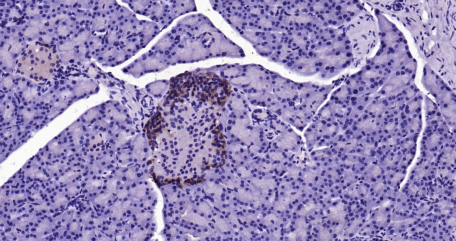 Paraformaldehyde-fixed, paraffin embedded Rat pancreas; Antigen retrieval by boiling in sodium citrate buffer (pH6.0) for 15min; Block endogenous peroxidase by 3% hydrogen peroxide for 20 minutes; Blocking buffer (normal goat serum) at 37°C for 30min; Antibody incubation with GPR55 Polyclonal Antibody, Unconjugated (bs-7686R) at 1:200 overnight at 4°C, DAB staining.
