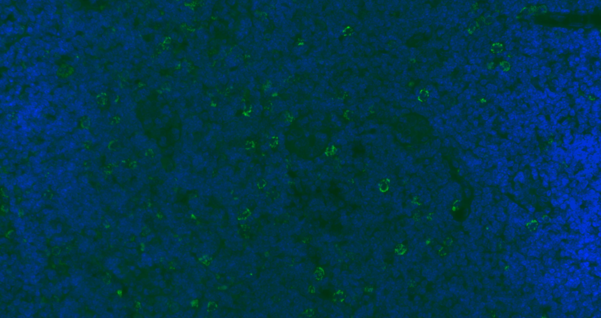 Paraformaldehyde-fixed, paraffin embedded Mouse lymph node; Antigen retrieval by boiling in sodium citrate buffer (pH6.0) for 15min; Blocking buffer (normal goat serum) at 37\u00b0C for 30min; Antibody incubation with CD8B Polyclonal Antibody, Unconjugated bs-4914R at 1:200 overnight at 4\u00b0C, followed by a conjugated Goat Anti-Rabbit IgG antibody (bs-0295G-AF488) for 90 minutes, and DAPI for nuclei staining.