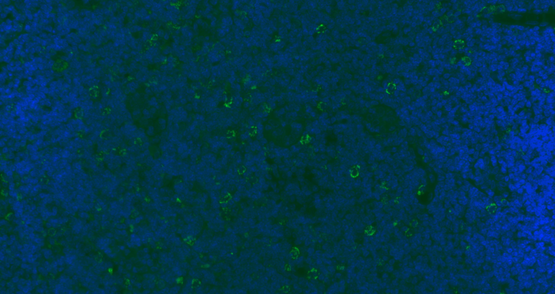 Paraformaldehyde-fixed, paraffin embedded Mouse lymph node; Antigen retrieval by boiling in sodium citrate buffer (pH6.0) for 15min; Blocking buffer (normal goat serum) at 37°C for 30min; Antibody incubation with CD8B Polyclonal Antibody, Unconjugated bs-4914R at 1:200 overnight at 4°C, followed by a conjugated Goat Anti-Rabbit IgG antibody (bs-0295G-AF488) for 90 minutes, and DAPI for nuclei staining.