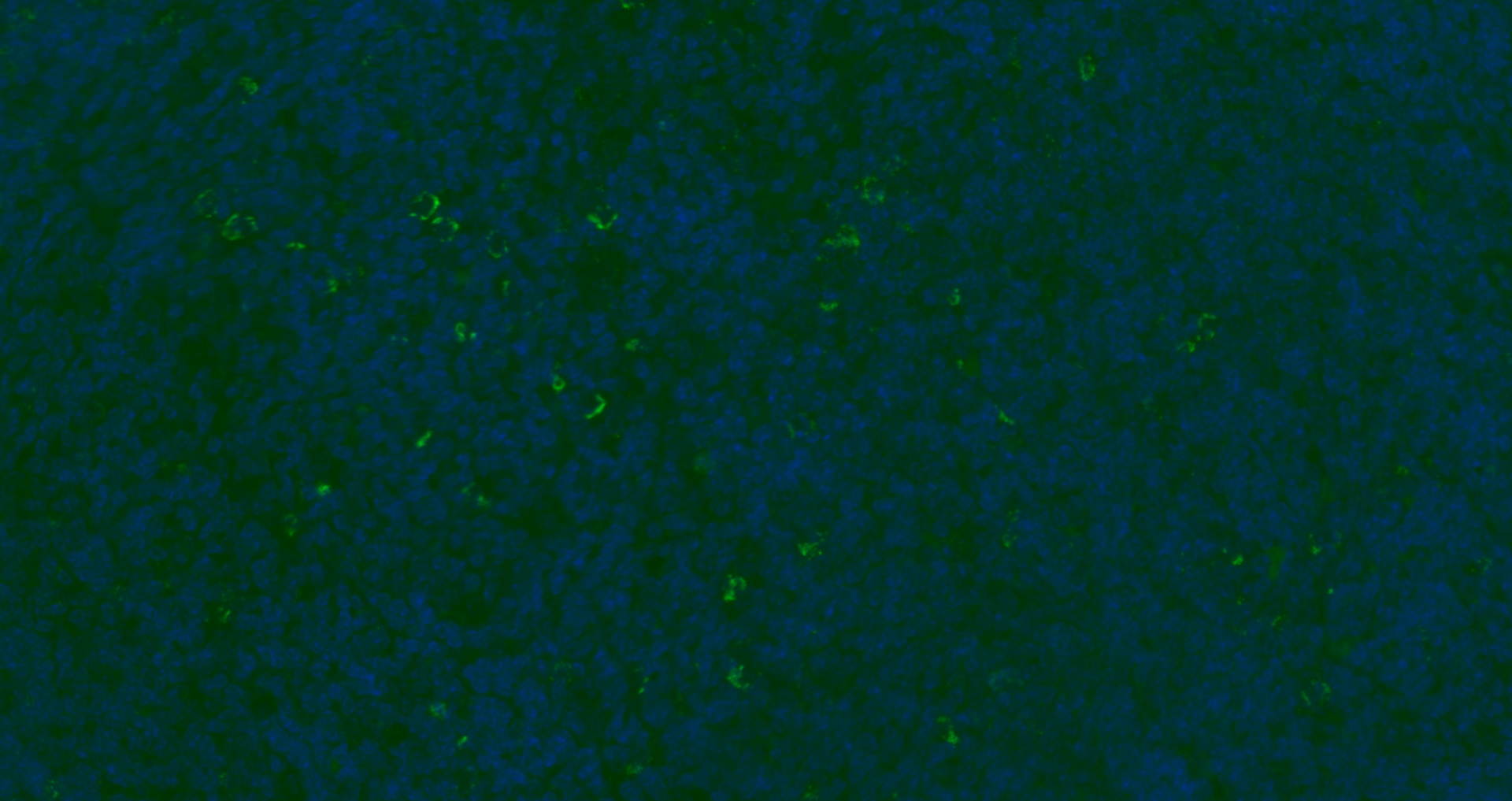 Paraformaldehyde-fixed, paraffin embedded Mouse thymus; Antigen retrieval by boiling in sodium citrate buffer (pH6.0) for 15min; Blocking buffer (normal goat serum) at 37°C for 30min; Antibody incubation with CD8B Polyclonal Antibody, Unconjugated bs-4914R at 1:200 overnight at 4°C, followed by a conjugated Goat Anti-Rabbit IgG antibody (bs-0295G-AF488) for 90 minutes, and DAPI for nuclei staining.