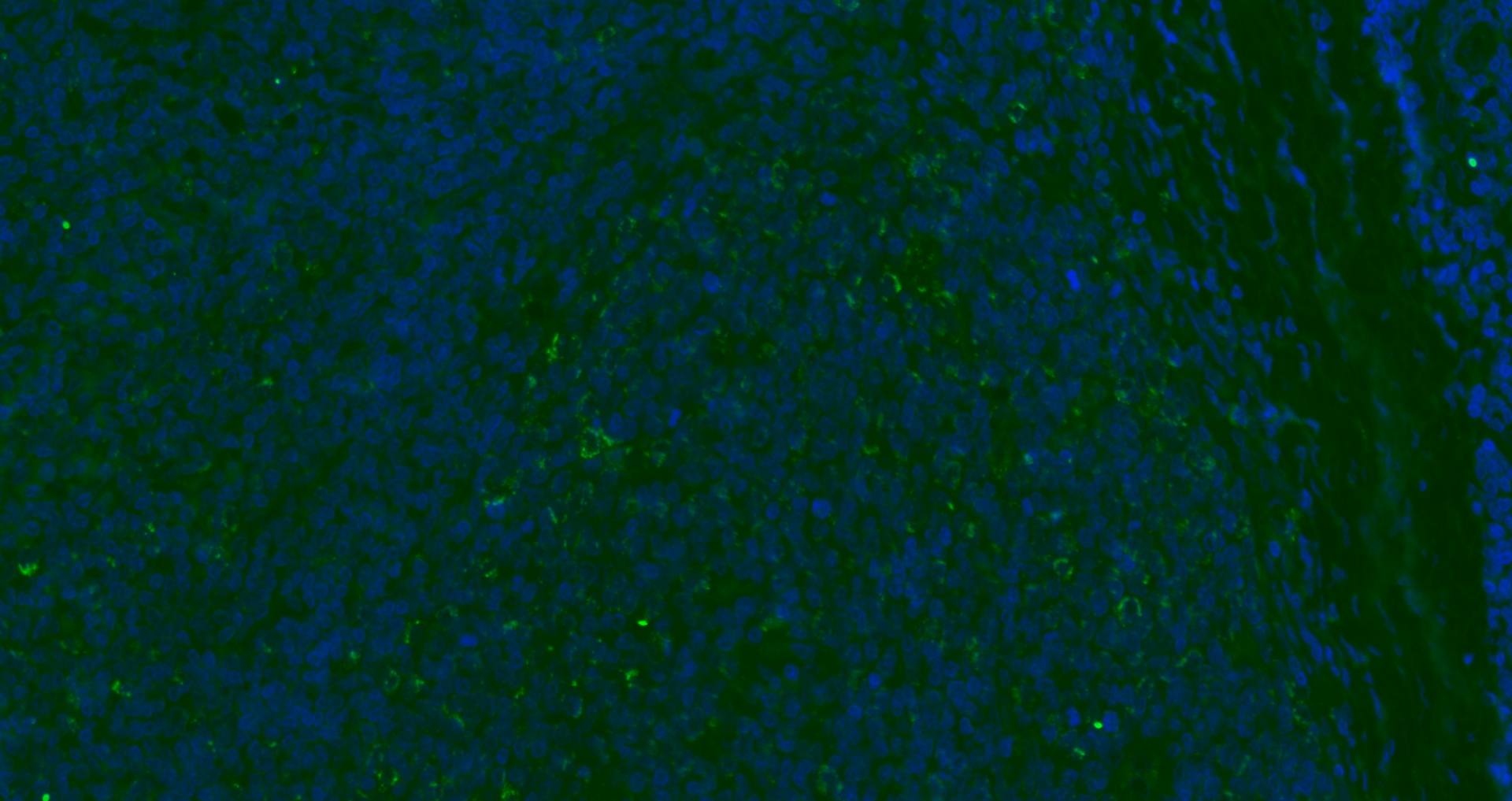 Paraformaldehyde-fixed, paraffin embedded Human tonsil; Antigen retrieval by boiling in sodium citrate buffer (pH6.0) for 15min; Blocking buffer (normal goat serum) at 37°C for 30min; Antibody incubation with CD8B Polyclonal Antibody, Unconjugated bs-4914R at 1:200 overnight at 4°C, followed by a conjugated Goat Anti-Rabbit IgG antibody (bs-0295G-AF488) for 90 minutes, and DAPI for nuclei staining.