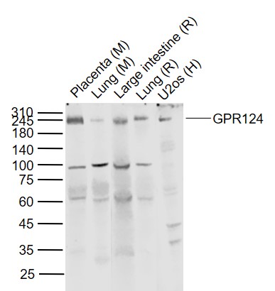 Lane 1: Mouse Placenta tissue lysates; Lane 2: Mouse Lung tissue lysates; Lane 3: Rat Large intestine tissue lysates; Lane 4: Rat Lung tissue lysates ; Lane 5: U2os cell lysates probed with GPR124 Polyclonal Antibody, Unconjugated (bs-13515R) at 1:1000 dilution and 4˚C overnight incubation. Followed by conjugated secondary antibody incubation at 1:20000 for 60 min at 37˚C.