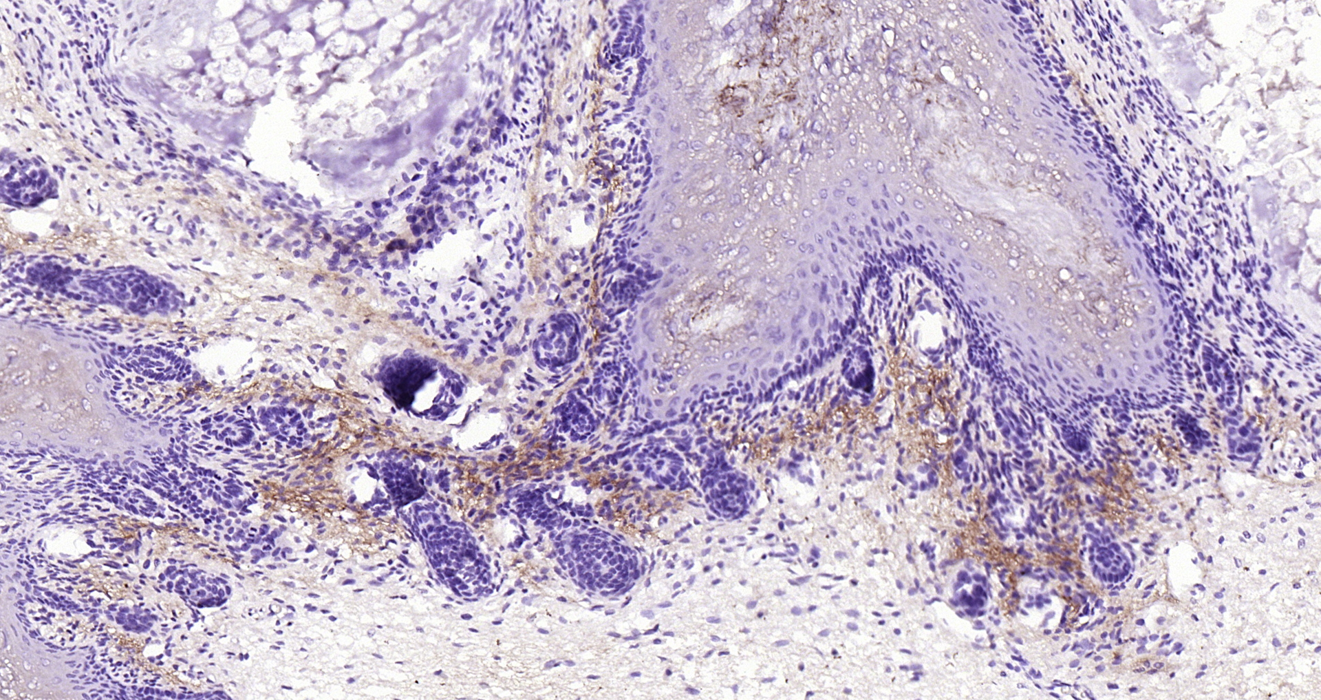 Paraformaldehyde-fixed, paraffin embedded (young rat paw); Antigen retrieval by boiling in sodium citrate buffer (pH6.0) for 15min; Block endogenous peroxidase by 3% hydrogen peroxide for 20 minutes; Blocking buffer (normal goat serum) at 37°C for 30min; Antibody incubation with (UCMA) Polyclonal Antibody, Unconjugated (bs-12378R) at 1:200 overnight at 4°C, followed by conjugation to the secondary antibody(SP-0023) and DAB(C-0010) staining.