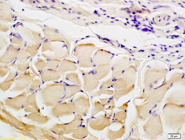 Formalin-fixed and paraffin embedded rat skin tissue labeled with Anti CTHRC1 Polyclonal Antibody, Unconjugated (bs-5882R) at 1:200 followed by conjugation to the secondary antibody and DAB staining