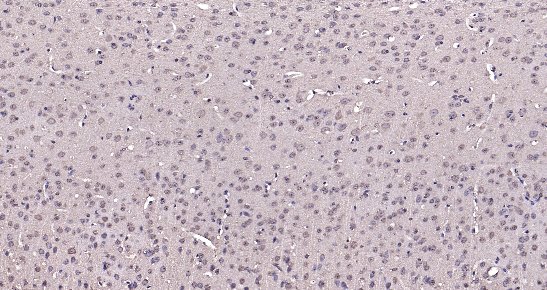 Paraformaldehyde-fixed, paraffin embedded Mouse brain; Antigen retrieval by boiling in sodium citrate buffer (pH6.0) for 15min; Block endogenous peroxidase by 3% hydrogen peroxide for 20 minutes; Blocking buffer (normal goat serum) at 37°C for 30min; Antibody incubation with Pyk2 (Tyr402) Polyclonal Antibody, Unconjugated (bs-3400R) at 1:200 overnight at 4°C, DAB staining.