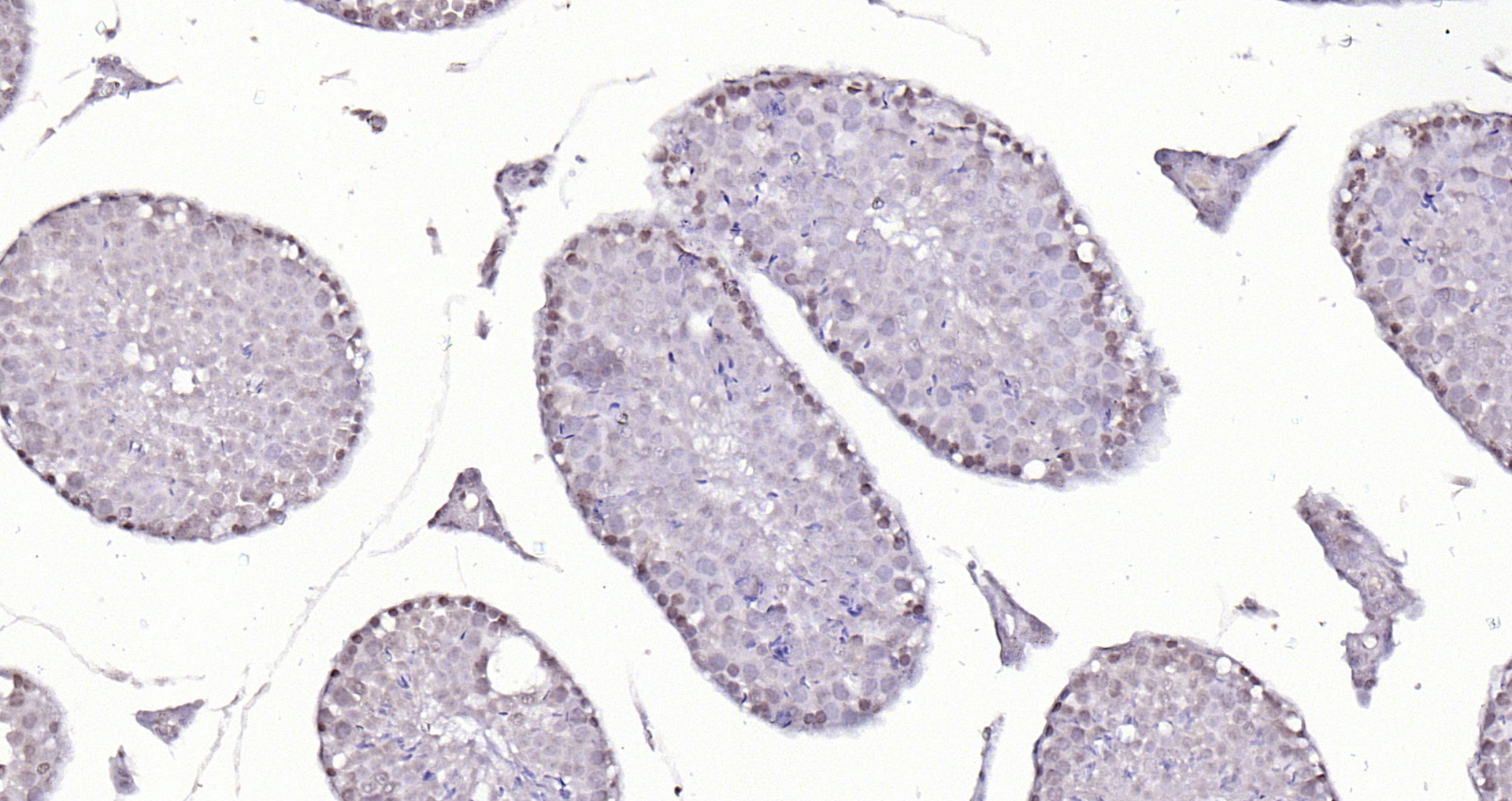 Paraformaldehyde-fixed, paraffin embedded Mouse testis; Antigen retrieval by boiling in sodium citrate buffer (pH6.0) for 15min; Block endogenous peroxidase by 3% hydrogen peroxide for 20 minutes; Blocking buffer (normal goat serum) at 37°C for 30min; Antibody incubation with LATS1/2 Polyclonal Antibody, Unconjugated (bs-4081R) at 1:200 overnight at 4°C, DAB staining.
