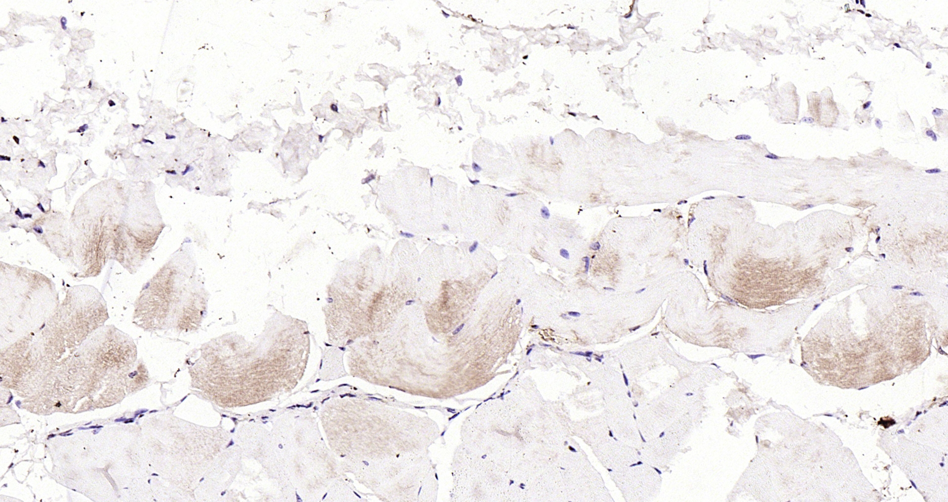 Paraformaldehyde-fixed, paraffin embedded Mouse muscle; Antigen retrieval by boiling in sodium citrate buffer (pH6.0) for 15min; Block endogenous peroxidase by 3% hydrogen peroxide for 20 minutes; Blocking buffer (normal goat serum) at 37°C for 30min; Antibody incubation with LATS1/2 Polyclonal Antibody, Unconjugated (bs-4081R) at 1:200 overnight at 4°C, DAB staining.
