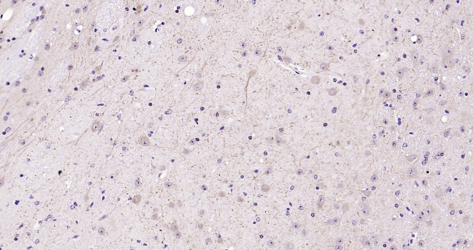 Paraformaldehyde-fixed, paraffin embedded Mouse brain; Antigen retrieval by boiling in sodium citrate buffer (pH6.0) for 15min; Block endogenous peroxidase by 3% hydrogen peroxide for 20 minutes; Blocking buffer (normal goat serum) at 37°C for 30min; Antibody incubation with LATS1/2 Polyclonal Antibody, Unconjugated (bs-4081R) at 1:200 overnight at 4°C, DAB staining.