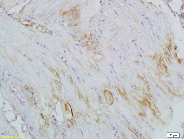 Formalin-fixed and paraffin embedded smooth muscle of rat colon labeled with Anti CTHRC1 Polyclonal Antibody, Unconjugated (bs-5882R) at 1:200 followed by conjugation to the secondary antibody and DAB staining