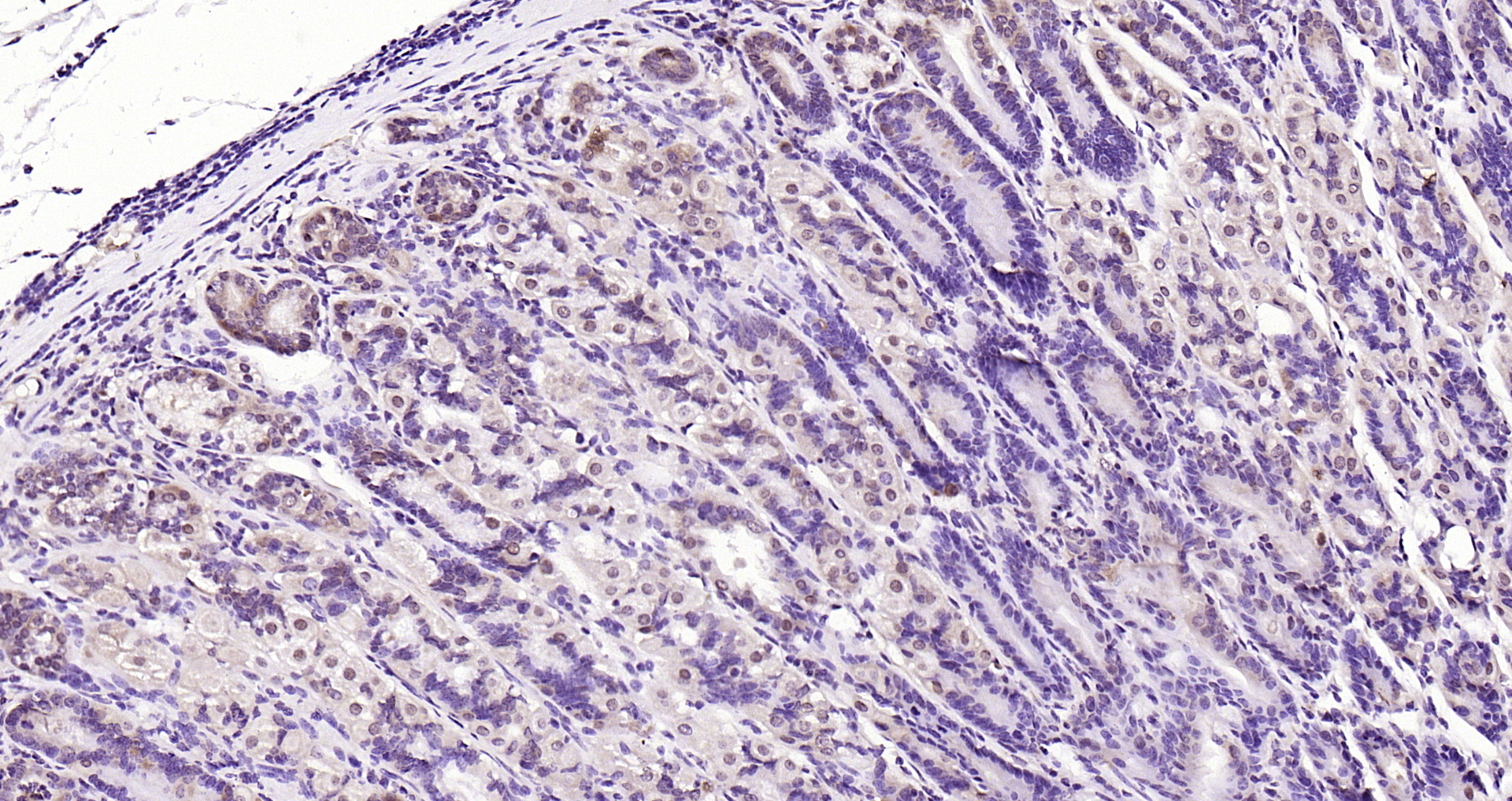 Paraformaldehyde-fixed, paraffin embedded Mouse stomach; Antigen retrieval by boiling in sodium citrate buffer (pH6.0) for 15min; Block endogenous peroxidase by 3% hydrogen peroxide for 20 minutes; Blocking buffer (normal goat serum) at 37°C for 30min; Antibody incubation with LATS1/2 Polyclonal Antibody, Unconjugated (bs-4081R) at 1:200 overnight at 4°C, DAB staining.